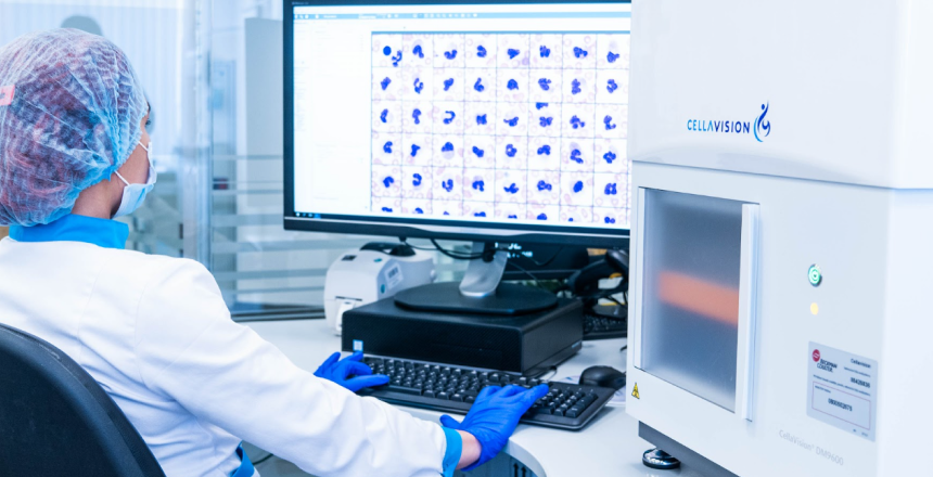 Фото - Лейкоцитарна формула крові: про що говорять результати аналізу