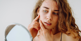 Картинка - Акне (угревая сыпь): симптомы, диагностика и лечение