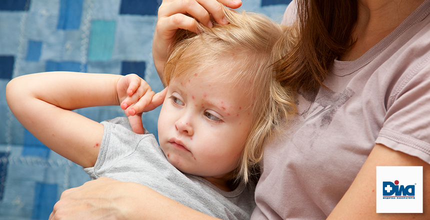 Фото - Сыпь на теле. Причины и угрозы