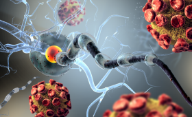 Картинка - Вторичные иммунодефициты