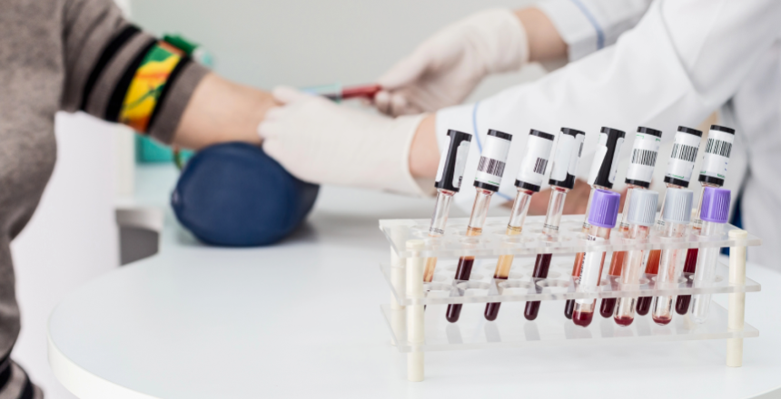 Фото - Аланинаминотрансфераза (АЛТ) и Аспартатаминотрансфераза (АСТ) в печеночных пробах