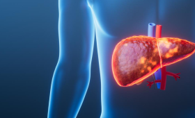 Картинка - МАСХП та МетАХП: нова термінологія, лабораторна діагностика та розбір клінічного випадку