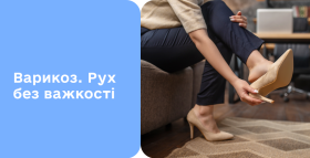 Картинка - Варикозна хвороба вен