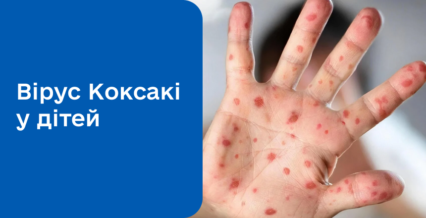 Фото - Коксакі у дітей: симптоми, лікування 