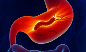 Картинка - Клінічний випадок: роль лабораторних досліджень у діагностиці Helicobacter pylori-асоційованого гастриту