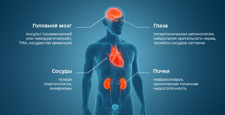 последствия повышенного артериального давления