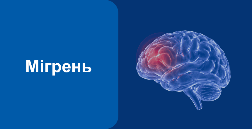 Фото - Мігрень: що це, причини, симптоми та лікування