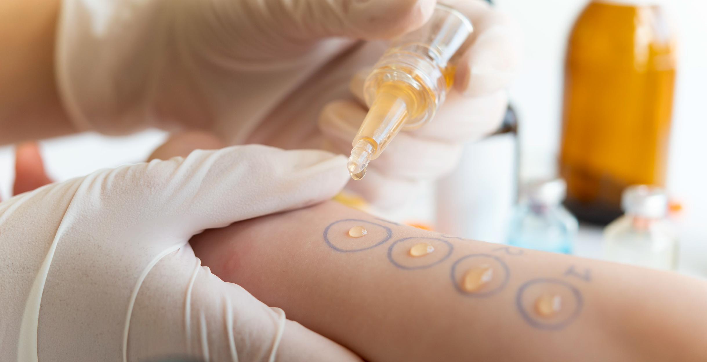 Фото - Европейские стандарты диагностики сезонной аллергии – украинские реалии