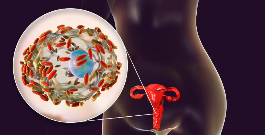 Фото - Новое исследование – микроскопия вагинальных выделений по критериям Хей-Айсон