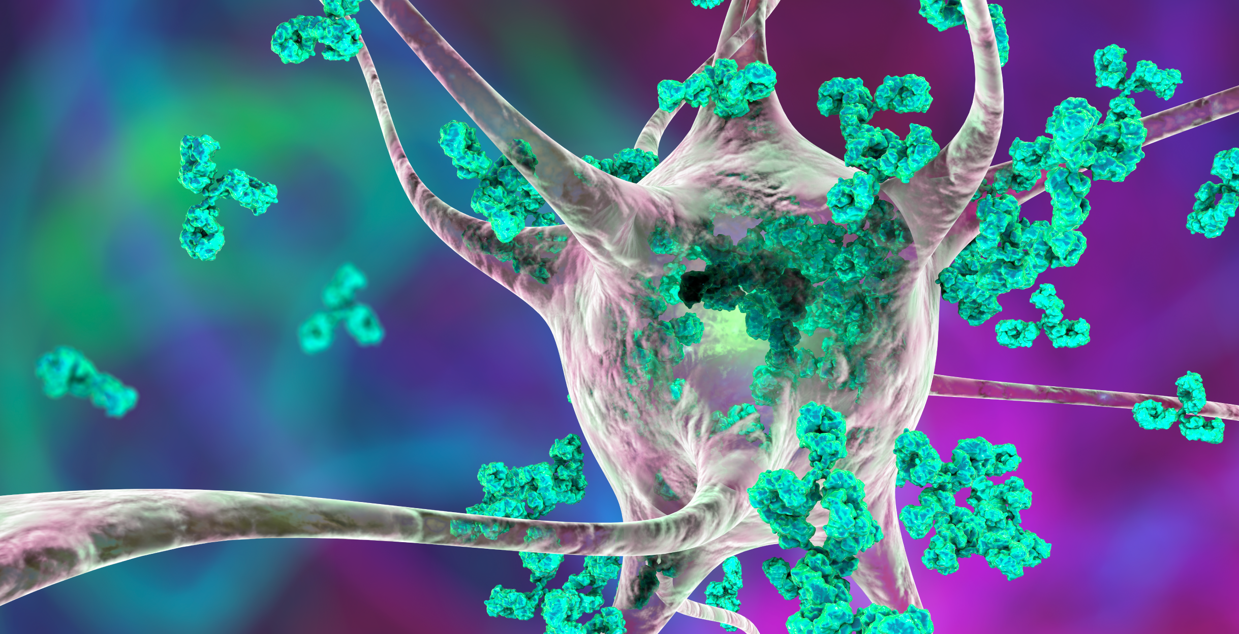 Фото - Аутоиммунные заболевания соединительной ткани: решение ДІЛА