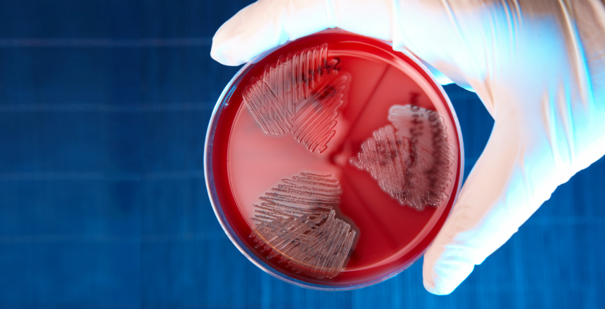 Фото - Инфекции в период беременности. Выявление стрептококка группы В