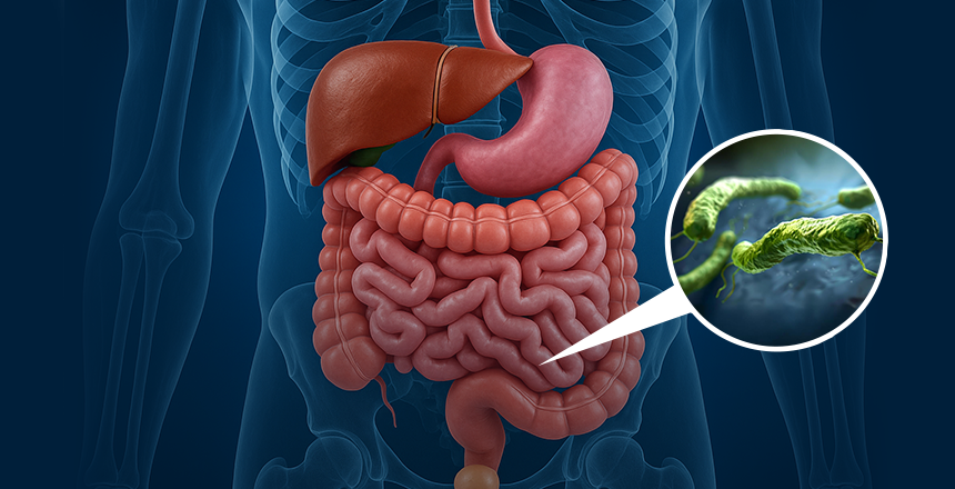 Фото - Лікування та діагностика інфекції Helicobacter pylori у пацієнтів з ішемічною хворобою серця