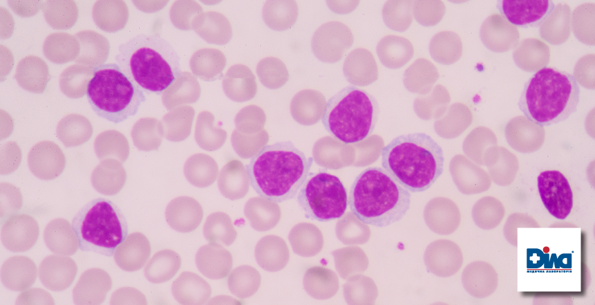 Фото - Лабораторное исследование онкогематологического профиля