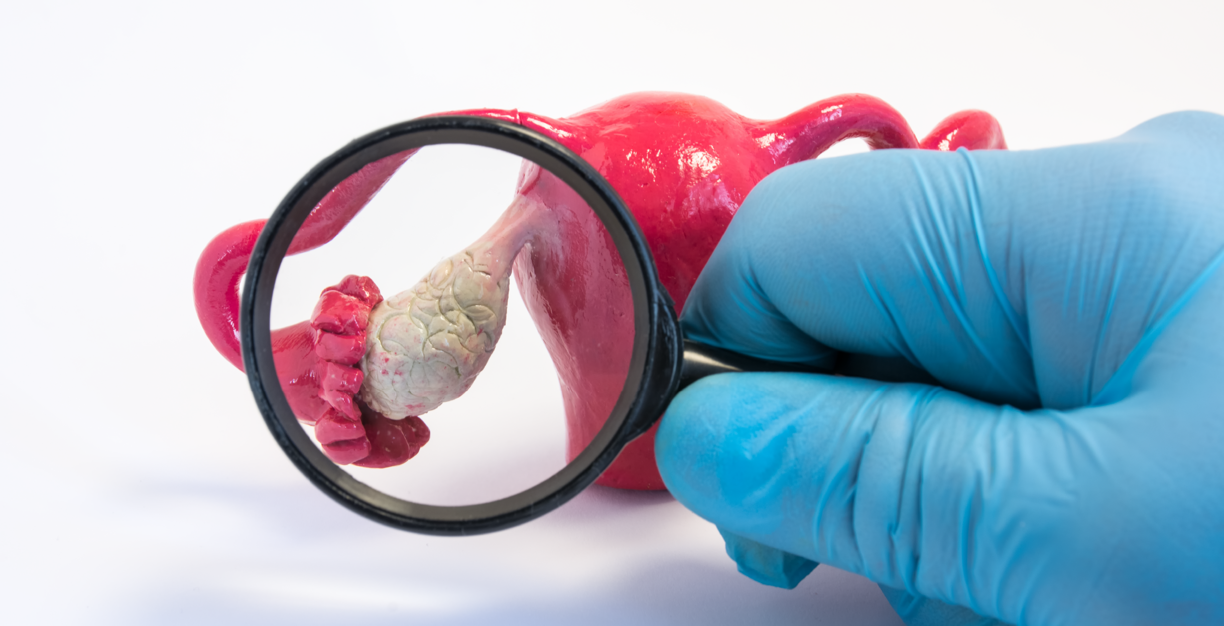 Фото - Гинекологические последствия инсулинорезистентности