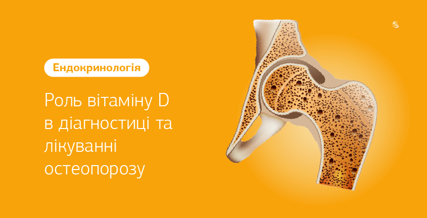 Фото - Роль витамина D в диагностике и лечении остеопороза